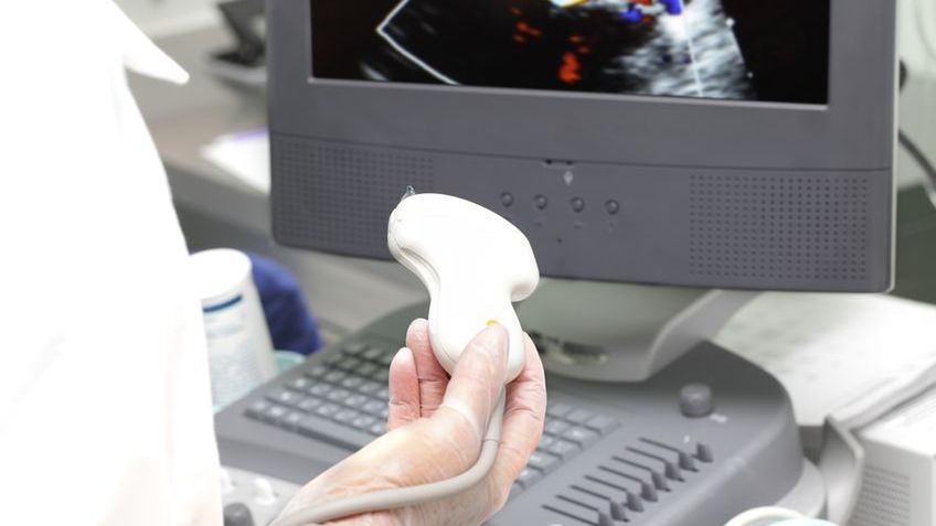 USG doppler to rodzaj badań ultrasonograficznych. USG doppler jest podstawowym badaniem w diagnostyce schorzeń układu krążenia