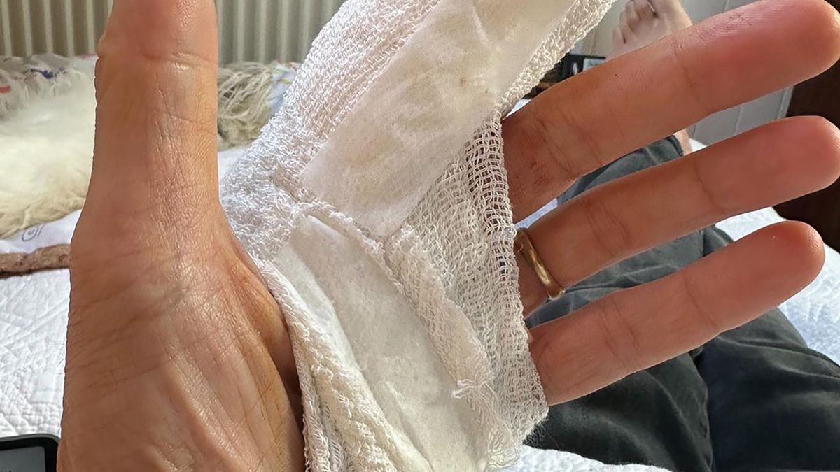 Wystarczyła chwila nieuwagi i nieszczęście gotowe.