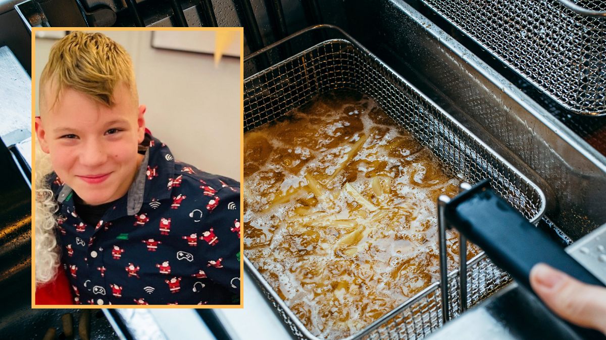 Gorąca frytura poparzyła mu ciało. Nowe wiadomości o stanie zdrowia Kuby. 