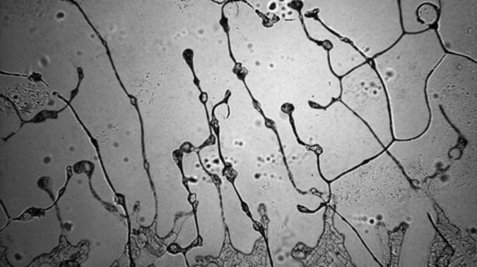 Łzy wyrażające tęsknotę