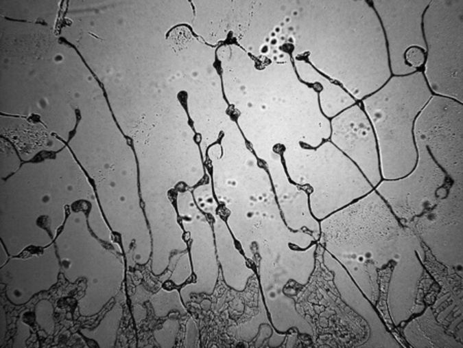 Projekt "topografia łez" - czym jest i co mówi o naszych łzach
