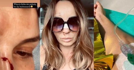 Agnieszka Włodarczyk TRAFIŁA DO SZPITALA. "Grzmotnęłam o podłogę. Obudziłam się we krwi"