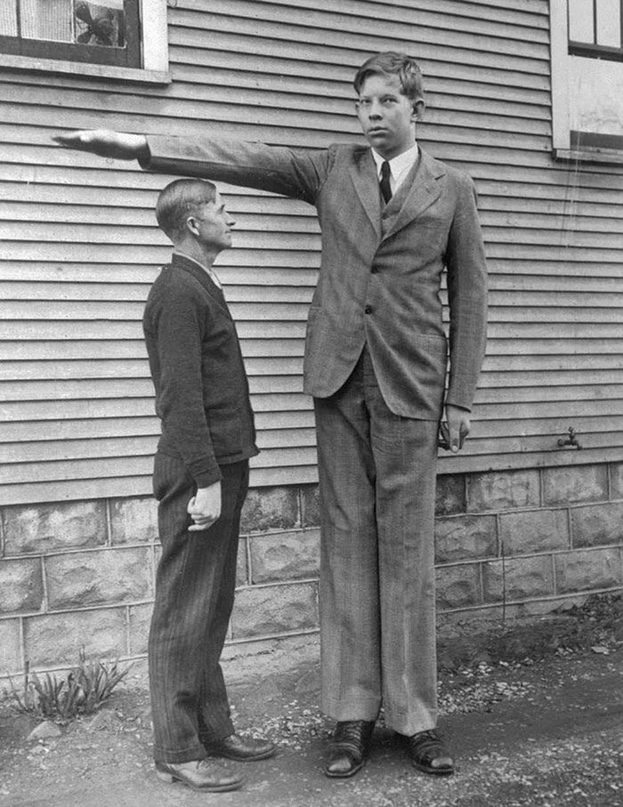 Robert Wadlow miał prawie 3 metry wzrostu. Zobacz historyczne zdjęcia 6