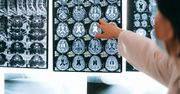 Masz ADHD? Eksperci ostrzegają przed tym, co może cię czekać