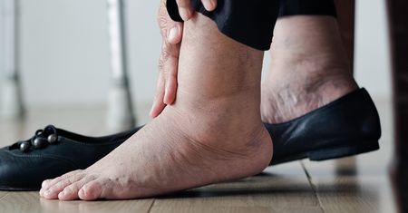 Alarmujący objaw. Może świadczyć o chorej wątrobie