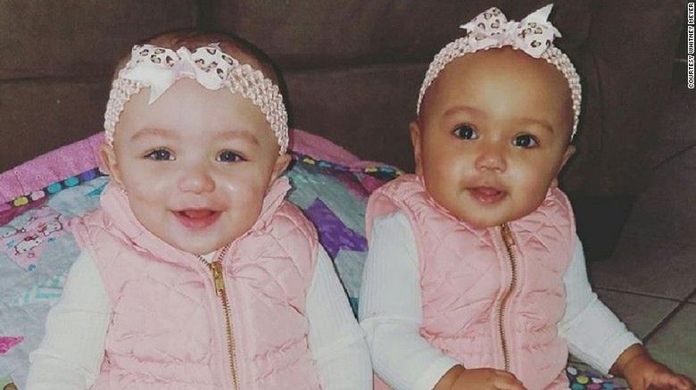 Kalani i Jarani Dean są bliźniaczkami o różnym kolorze skóry