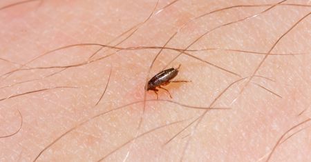 Ugryzienie pchły – jak wygląda, leczenie, jakie choroby przenoszą pchły