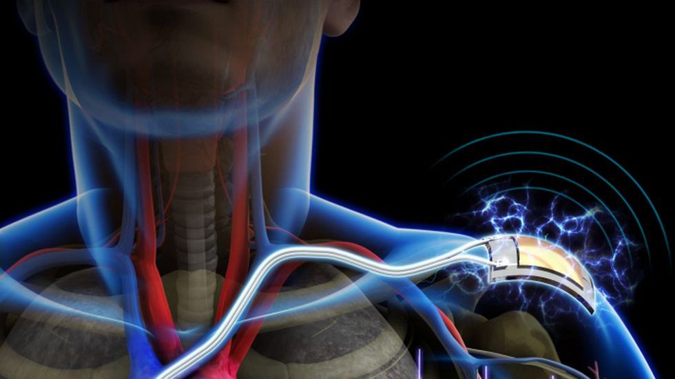 Nauka dogoniła "Matriksa" - człowiek jest źródłem energii dla wszczepionej w ciało elektroniki 1