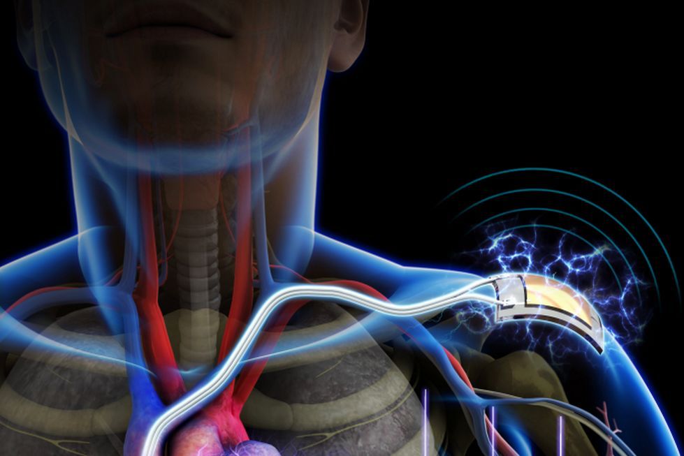 Nauka dogoniła "Matriksa" - człowiek jest źródłem energii dla wszczepionej w ciało elektroniki
