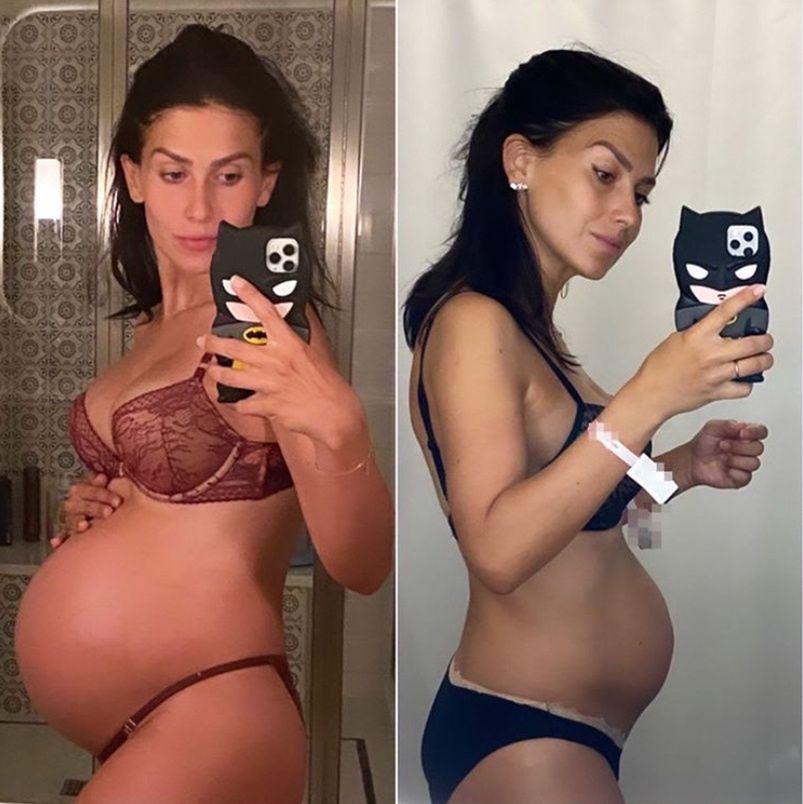 Hilaria Baldwin 