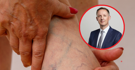 Siedzenie ze skrzyżowanymi nogami zwiększa ryzyko rozwoju chorób żył. Lekarz ostrzega