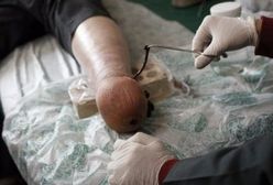 Obciął sobie stopę, żeby nie pracować!