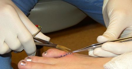 Dwa miliony odszkodowania za wypadek w pracy