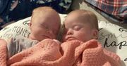 Sugerowali jej aborcję. Tak niezwykłe bliźniaczki wyglądają dzisiaj