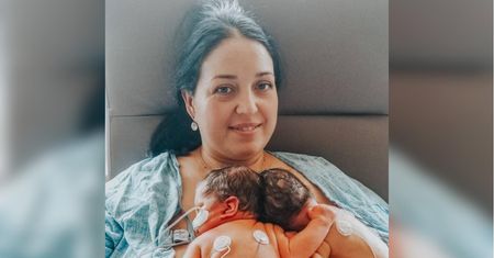 Urodziły się zrośnięte głowami. Tak wyglądają 5 lat po operacji