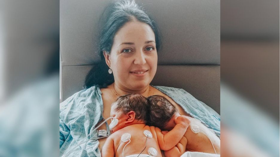 Bliźniaczki syjamskie już są rozdzielone