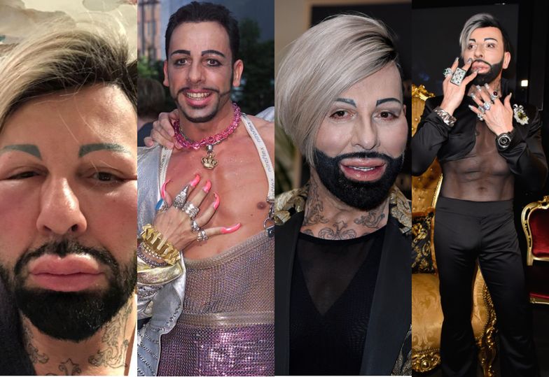 Poznajcie Haralda Glööcklera, najsłynniejszego projektanta z Niemiec, który wydał na "poprawianie urody" PONAD 100 TYSIĘCY EURO