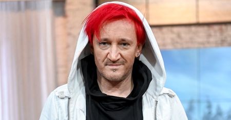 Michał Wiśniewski od lat zmaga się z nieuleczalną chorobą. "Zaczęło mi to atakować twarz"