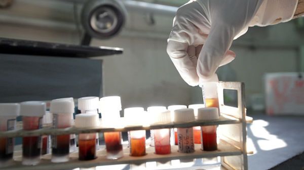 Na świecie ok. 34 mln ludzi jest nosicielami HIV