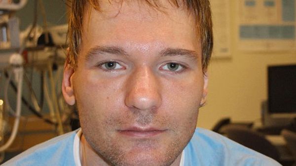 Mężczyzna obudził się w szpitalu i niczego nie pamięta