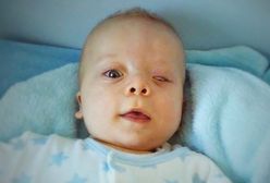 10-miesięczny Szymon ma poważną wadę serca. Potrzebna pomoc i fundusze na operację w Niemczech