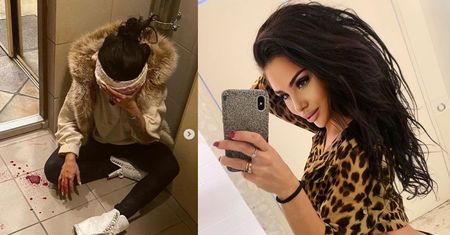 Influencerka twierdzi, że została brutalnie pobita: "Tłukli mnie po całym ciele"