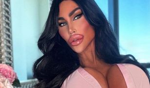 Niewiarygodne, jak "australijska Barbie" wyglądała przed operacjami plastycznymi. Wydała na nie fortunę