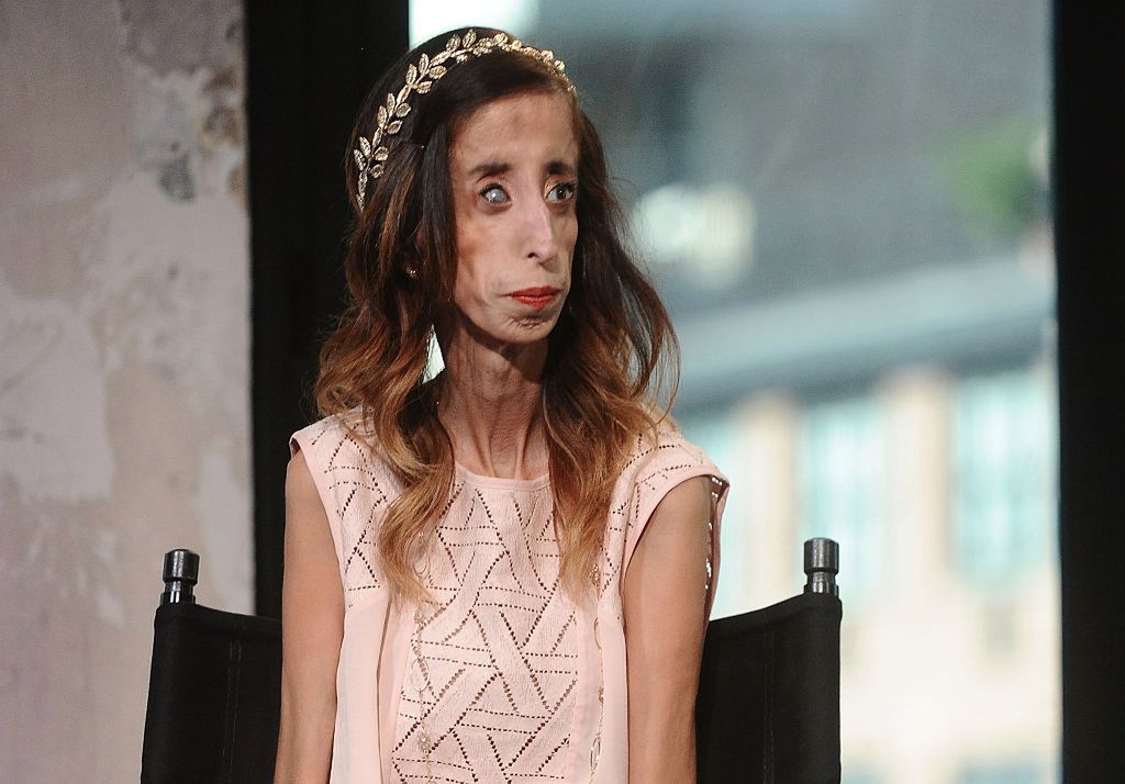 Lizzie Velásquez jest dziś mówcą motywacyjnym