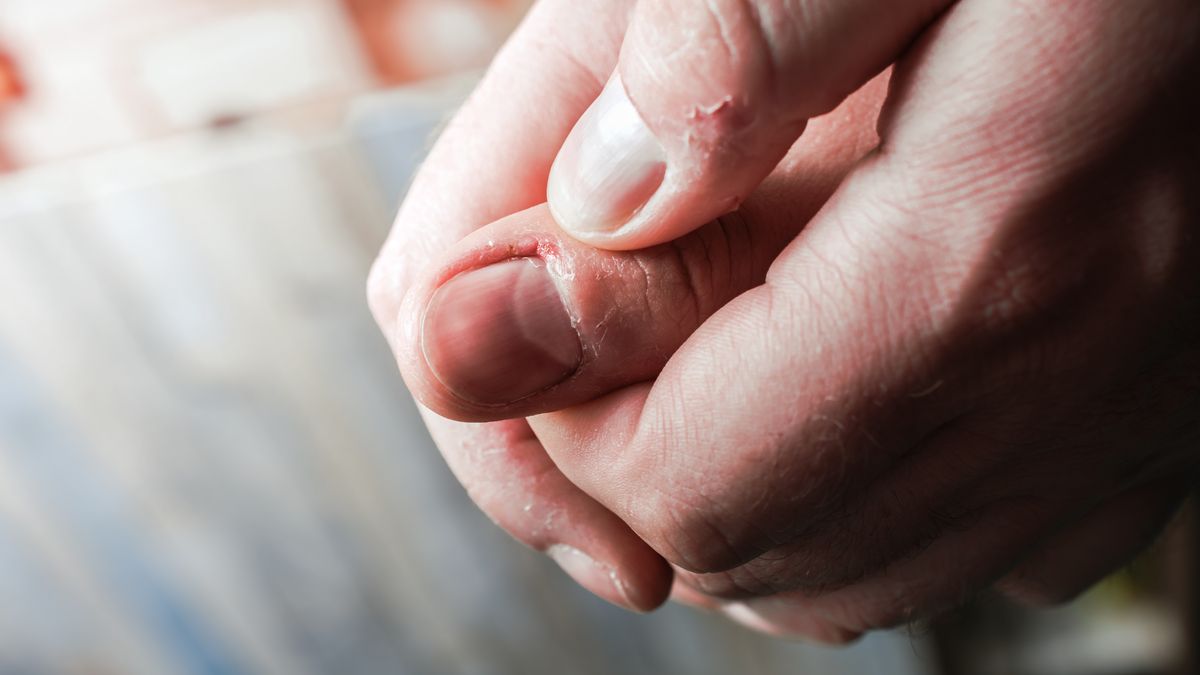 Zastrzał może powodować pulsujący ból