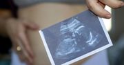 Fetus in fetu – jak rozpoznać bliźniaka pasożytniczego?