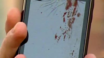 Motorola Milestone 2 wybuchła przy uchu Amerykanina 1