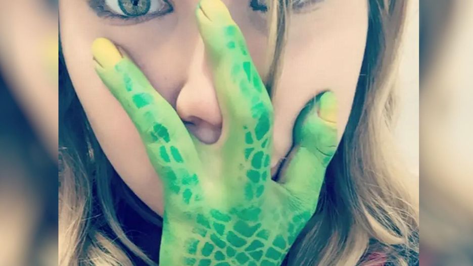 Urodziła się z trzema palcami. W szkole nazywali ją dinozaurem