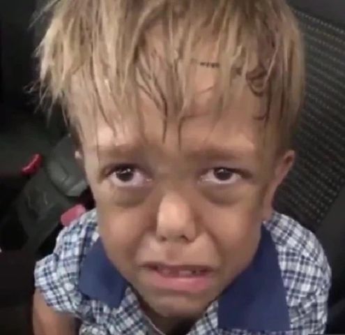 9-letni chłopiec jest nękany w szkole ze względu na karłowatość