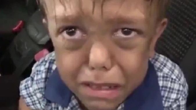 9-letni chłopiec jest nękany w szkole ze względu na karłowatość