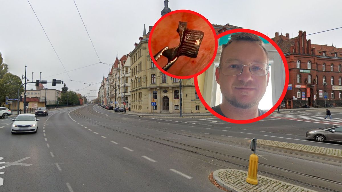 Marcin Lewicki pokazał, co wyciągnęli z jego oka.