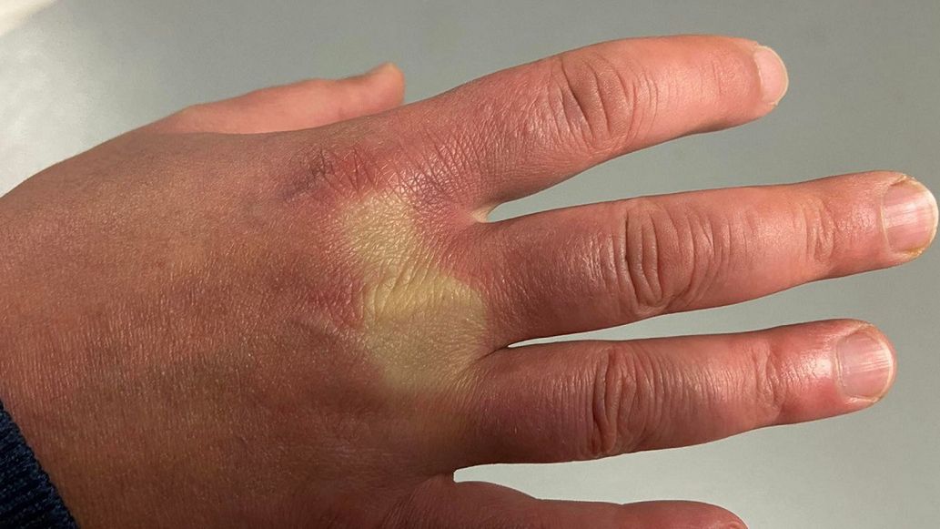 Zwróć uwagę na takie ovbjawy