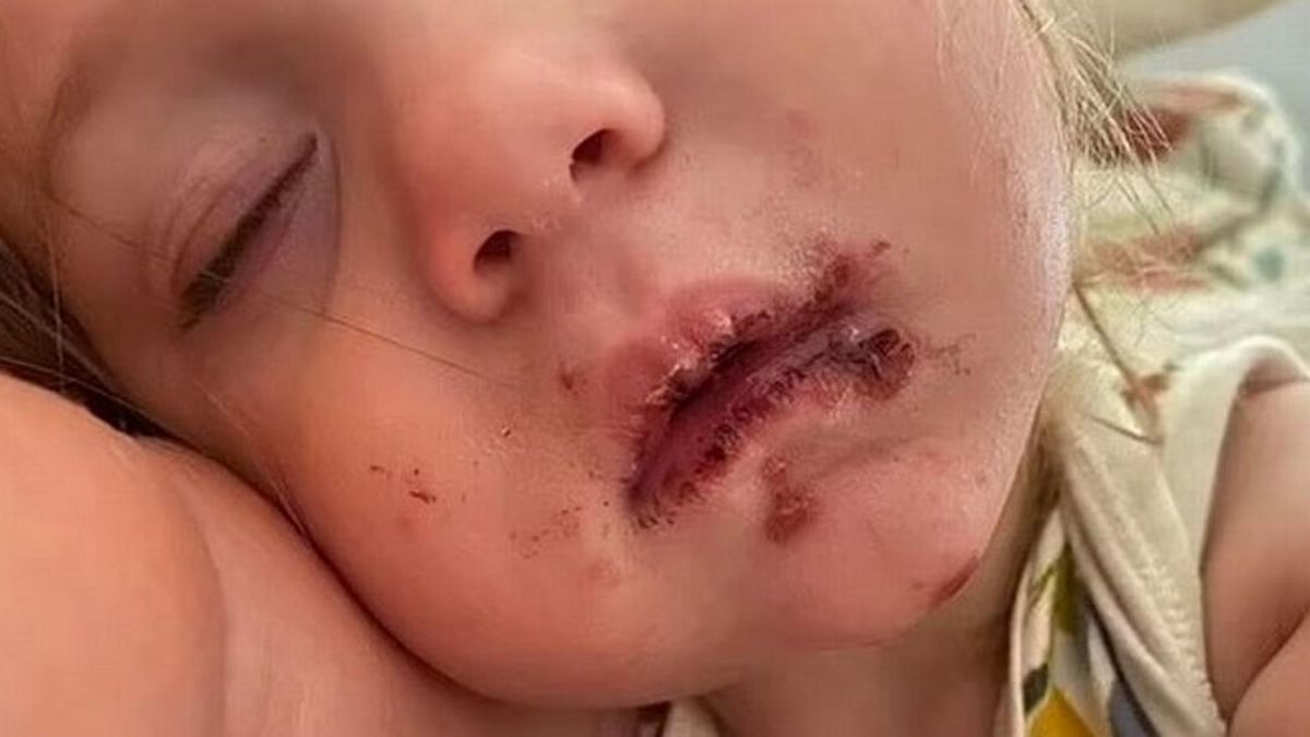 Jej córka została pocałowana w usta. Mama ostrzega rodziców