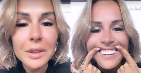 Blanka Lipińska tłumaczy internautom, co się stało z jej górną wargą: "Nierówno mi się ROZPUŚCIŁO" (FOTO)