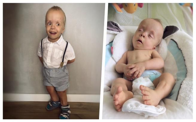 Rodzice Adasia zrezygnowali z aborcji. Dziś chłopiec ma prawie 5 lat 