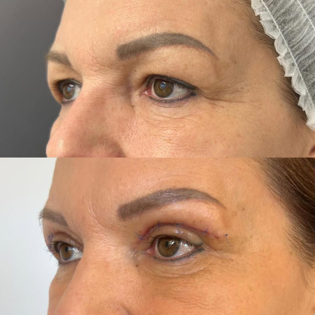 Ilona Felicjańska "przed" i "po"