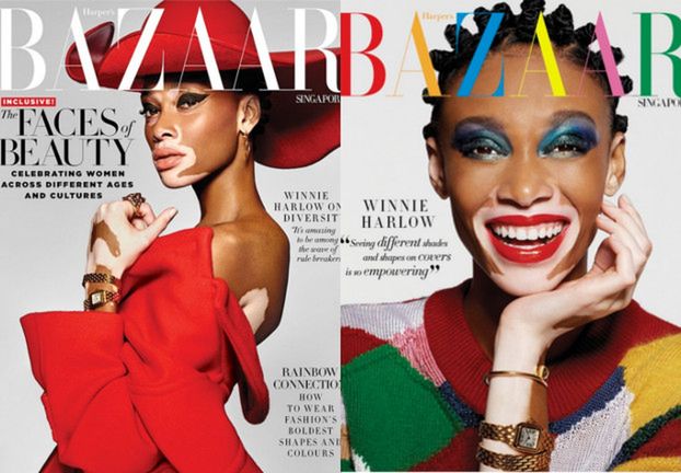 Modelka z bielactwem na okładce "Harper's Bazaar"