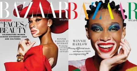 Modelka z bielactwem na okładce "Harper's Bazaar"