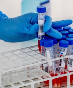 Koronawirus w Polsce. Dr Grzesiowski: Jeśli rząd nie przygotuje planu na jesień, czeka nas katastrofa