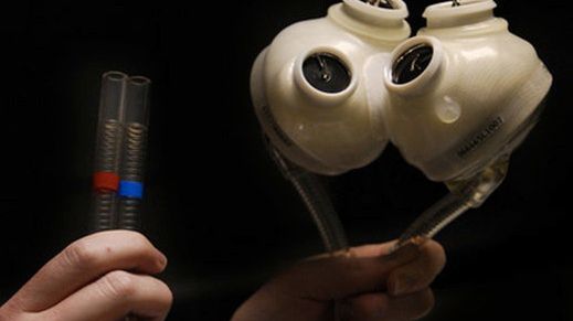 Cyberwnętrze, czyli najnowocześniejsze sztuczne narządy wewnętrzne i implanty 1