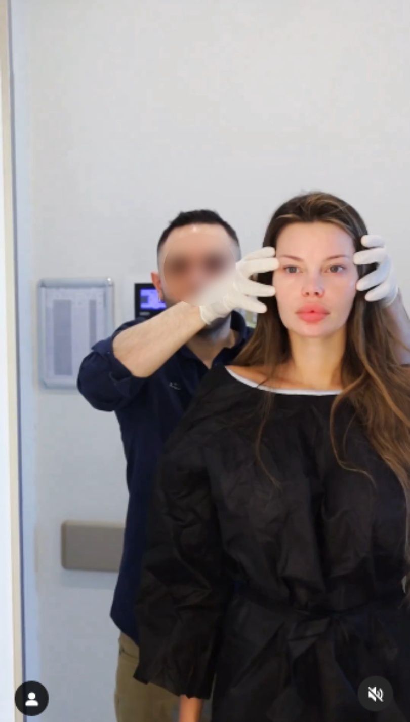Justyna Gradek zafundowała sobie lifting w tureckiej klinice. Chirurg pokazał nagranie