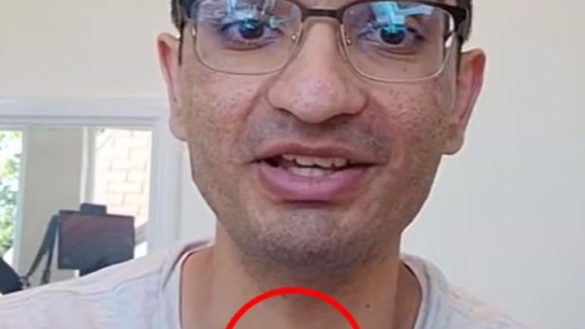 Aaroh Mankad miał wyraźnie powiększoną tarczycę. To nie uszło uwadze widzów tiktokera 