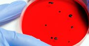 Zabójcze bakterie. Pilnie potrzebne nowe antybiotyki