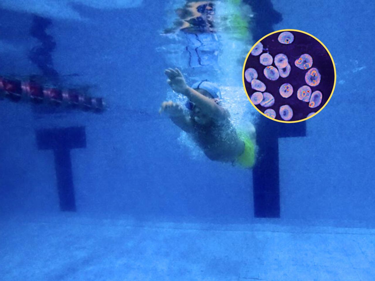 "Zjada mózg".To wyjatkowo niebezpieczny mikrooorganizm