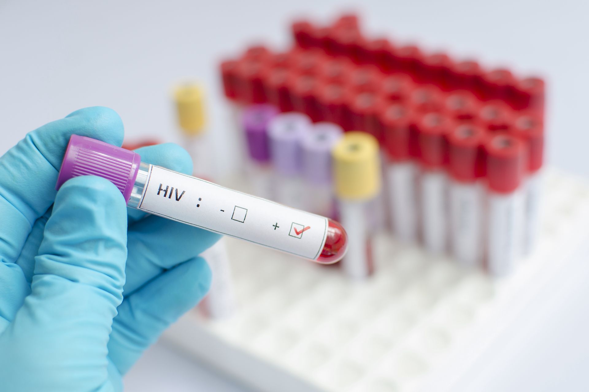 Zmiany klimatu zwiększają ryzyko zakażeń HIV -.NewRequest odkrycia