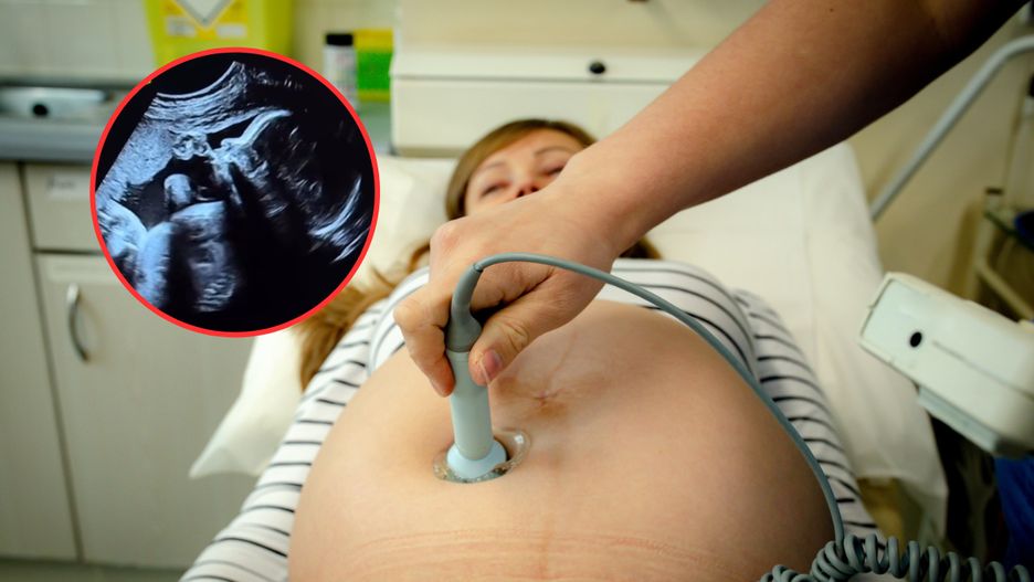 Kamera USG wychwyciła urocze zachowanie dziecka